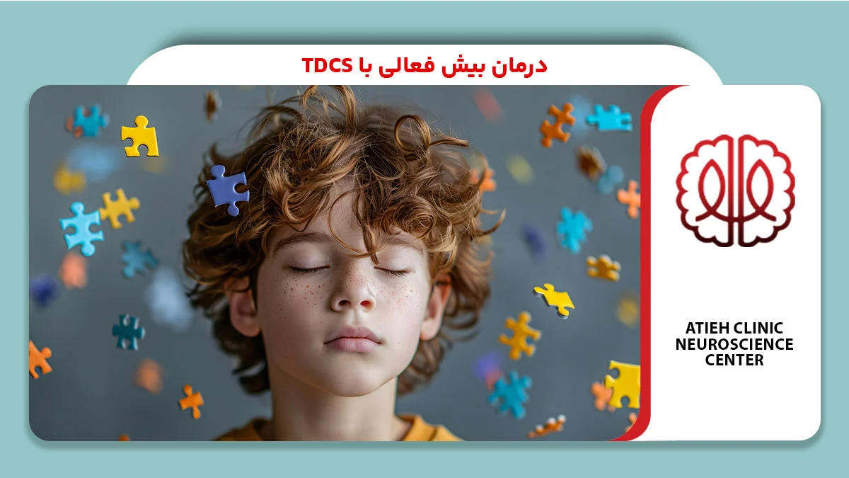 درمان بیش فعالی با tdcs