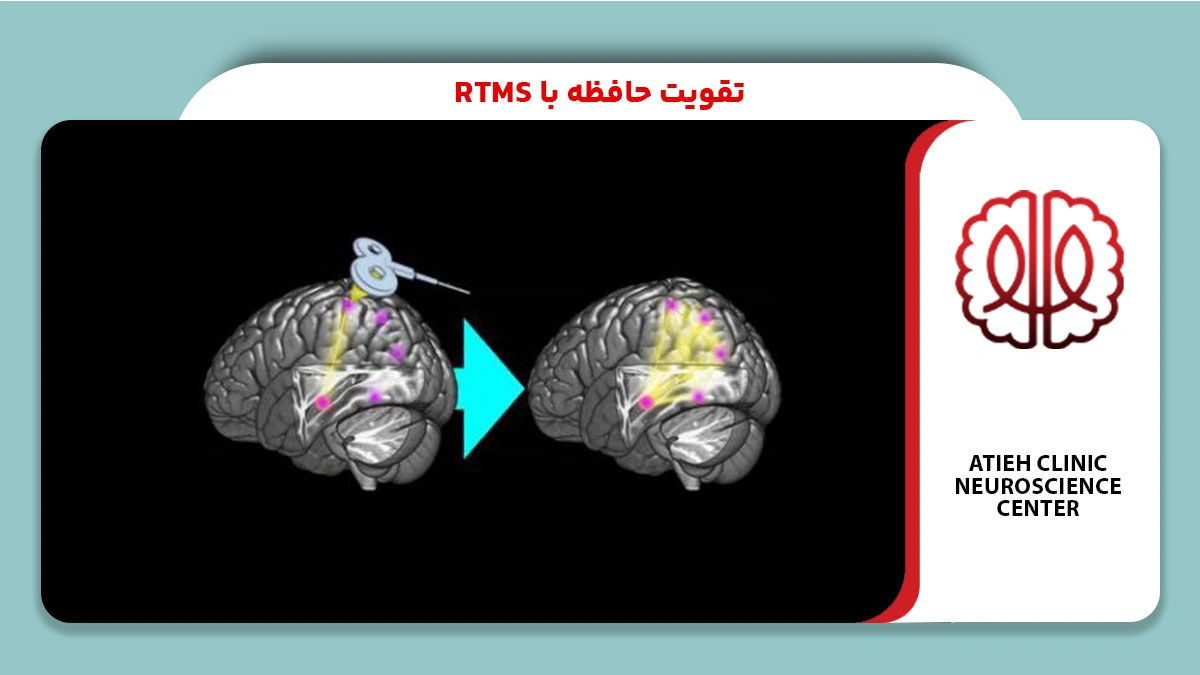تقویت حافظه با rtms
