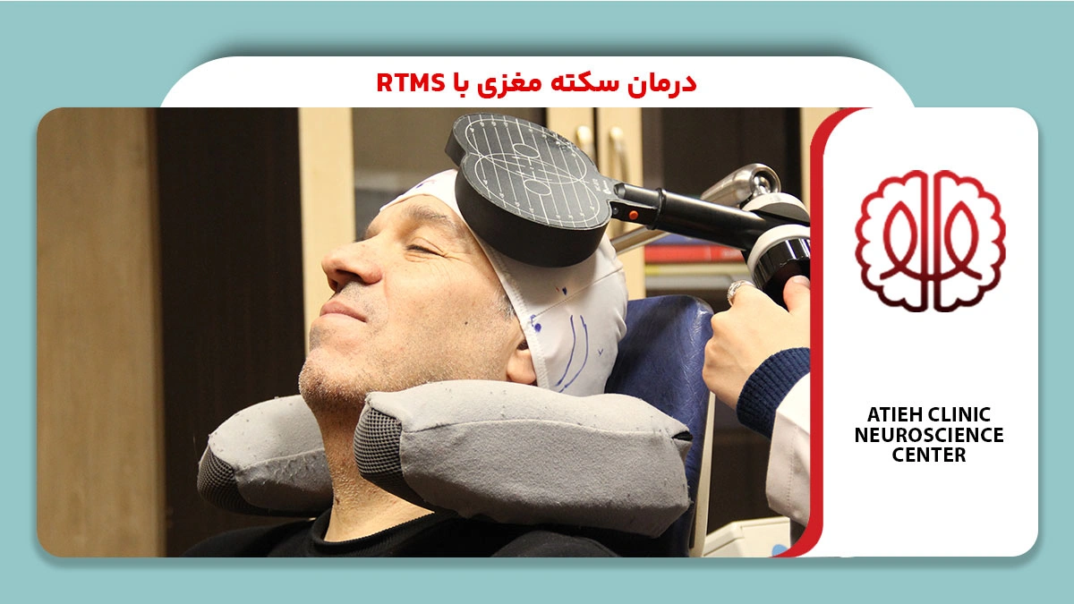 درمان سکته مغزی با rTMS